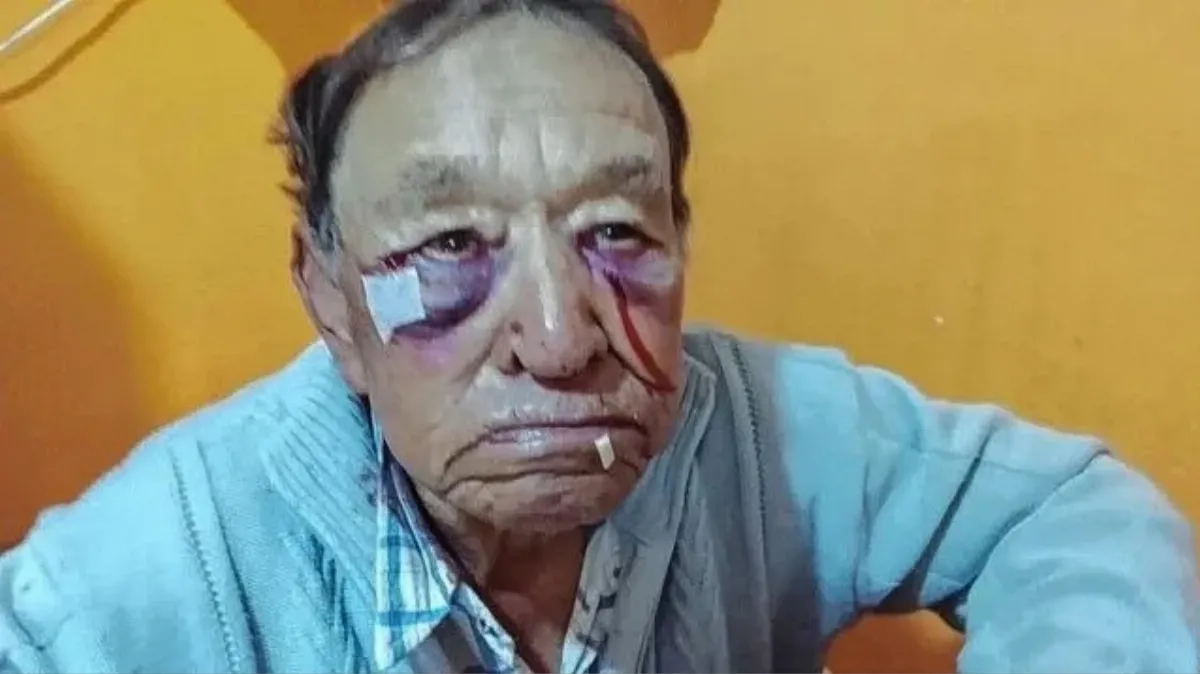 Un hombre habría resultado lesionado tras un episodio de violencia en Domínguez